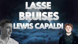 Lewis Capaldi  Bruises feat Lasse Skriver MOBILE RECORDED [upl. by Emelen]