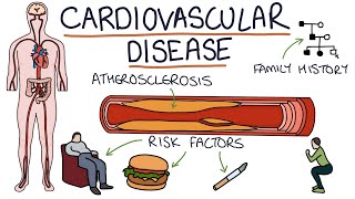 Understanding Cardiovascular Disease Visual Explanation for Students [upl. by Asined319]