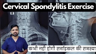 Exercises for cervical spondylitis  Cervical spondylosis exercise in hindi  gardan ki exercise [upl. by Berthe]