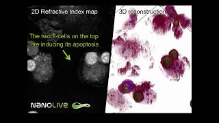 The perfect murder  Macrophage cell killed by Tcells [upl. by Viridi]