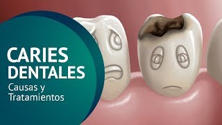 Caries Dental en Niños  Juan Salgado  ceries dental en niños [upl. by Nomead]