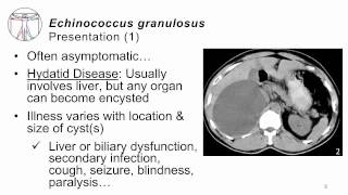 Helminths E granulosus [upl. by Drucilla]