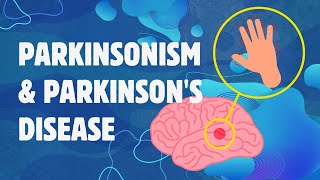 Understanding Parkinsonism and Parkinsons Disease [upl. by Rehpotsyrk]