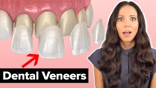 Dental Veneers Procedure Explained [upl. by Nedla]