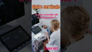 Glaire cervicale  à quoi ressemble telle à léchographie [upl. by Knarf]