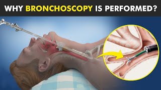 Bronchoscopy  Procedure To View Inside Of Air Ways [upl. by Whall]