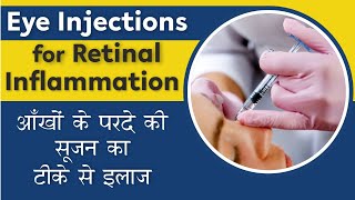 All about Eye Injections for Retina  Eye Cancer injection  आँखों के परदे की सूजन का टीके से इलाज [upl. by Wehner920]