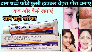 Ciprolar fc cream  Ciprolar fc cream ke fayde  दाग धब्बे फोड़े फुंसी का क्रीम  acne pimple cream [upl. by Lolanthe]