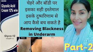 Glyco12 का सही इस्तेमाल Removing Blackness in Underarm Acne scars pigmentationMelasmaAcne [upl. by Ynnot]