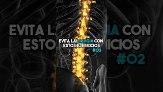 Hernia discal ejercicio para evitar la cirugía ✅ P2 fisioterapiatualcance [upl. by Astri]