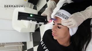 DERMAQUAL DERMAECLAT SKIN WHITENING MESOTHERAPY WITH FORZA MMS 007 [upl. by Htes584]