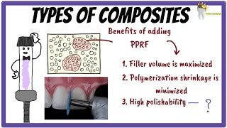 Types of DENTAL COMPOSITES  small particle microfilled hybrid nanofilled composites [upl. by Iow682]