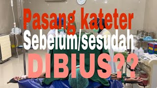 Boleh gak request pasang KATETER setelah DIBIUS [upl. by Diamante]