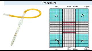 Total WBC counting by using hemocytometer  Neubaurs Chamber  urduhindi [upl. by Ling]