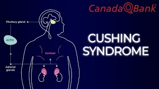 Cushing Syndrome [upl. by Millie]