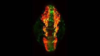 Tgsnai1bGFP labels neuroepithelial cells predicted to undergo EMT and form neural crest cells [upl. by Eidnarb725]