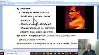 Arterial Disorders in Arabic 27  Buergers Disease  part 1   by Dr Wahdan [upl. by Maida]