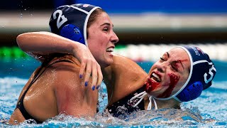 The Top 5 Most Devastating Water Polo Injuries of All Time [upl. by Sidhu]