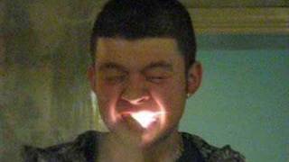 Mathew Iron Mouth cap in teeth Stupid Funny Explotion [upl. by Redan]