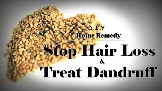 How To Stop Hair Loss and Treat Dandruff At Home Treatment and make hair grow long really fast [upl. by Jeannette650]