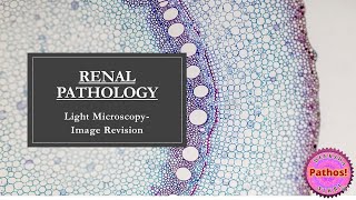 Renal Pathology Image Based Revision [upl. by Essy]