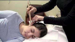 Do Ear Candles Remove Earwax Fact or Fiction Ear Candling [upl. by Senaj]