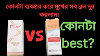 clindax lotion ReviewClinex Lotion ReviewHow to use Clinex LotionHow to use clindax LotionBangla [upl. by Giguere]