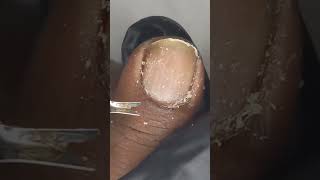 quotDeep Clean Pedicure How to Remove Dead Skin amp Smooth Out Nails Professionallyquot [upl. by Atnod]