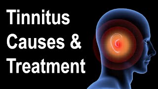 What is Tinnitus Causes amp Treatment Strategies [upl. by Ahsienak]