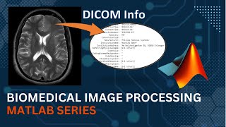 Getting Info of DICOM file  MATLAB  Medical Image Processing [upl. by Reedy638]