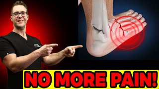 Hairline Stress Fracture in the Foot Symptoms amp Best TREATMENT [upl. by Ytsirc386]