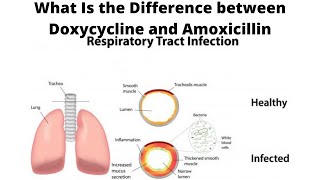 What Is the Difference between Doxycycline and Amoxicillin [upl. by Megdal861]