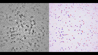 Cells flowing in a microfluidic cell culture device for studying immune cell behavior [upl. by Lustig]