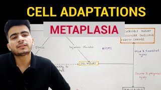 Metaplasia  Cell Adaptations 33  General Pathology  EOMS [upl. by Bijan]