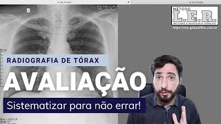 O maior Segredo de quem não perde lesões na Radiografia de Tórax  Galvani Filho [upl. by Justinian]