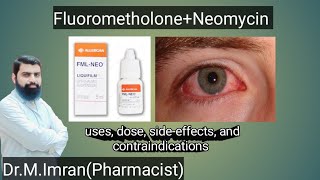 FML NEO eye drops are used in urdu  eye drops  Medicine information [upl. by Aremmat]