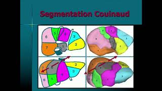 Traitement chirurgical des kystes hydatiques du foie par colloscopie [upl. by Christean]