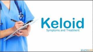 Keloid Symptoms and Treatment [upl. by Bender]