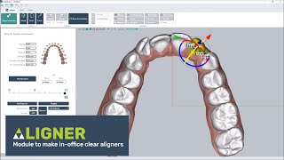 Clear aligner software thermoforming or direct printing [upl. by Ainattirb502]