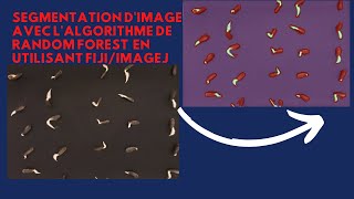 Segmentation dimage avec lalgorithme de random forest en utilisant FijiImageJ [upl. by Glorianna]