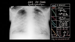 Gaz du sang en 7 étapes  Approche systématique  Partie 2  Docteur Synapse [upl. by Hadihahs]