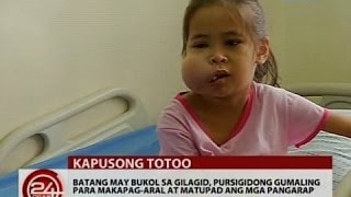 Batang may bukol sa gilagid pursigidong gumaling para makapagaral at matupad ang mga pangarap [upl. by Aettam]