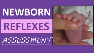 Newborn Reflexes Assessment Infant Nursing Pediatric NCLEX Review [upl. by Thurnau852]