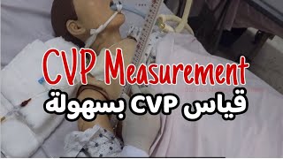 CVP procedure ENAR  CVP طريقة قياس [upl. by Earezed]