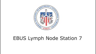 EBUS Lymph Node Station 7 [upl. by Schaffel35]