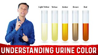 What Urine Color Indicates About Your Body – DrBerg [upl. by Ainahs]