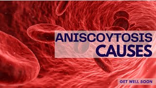 Anisocytosis Causes [upl. by Anesuza]