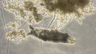 Activated Sludge microscopic exam Tardigrade Type 021N Stalked ciliates Phase contrast [upl. by Beghtol154]