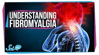 Real Pain and Explosive Brains  Fibromyalgia [upl. by Eelyram]