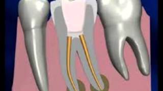 Relación de otras especialidades con la endodoncia [upl. by Irim301]